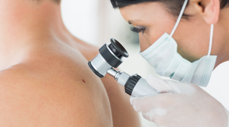 ce este dermatoscopia digitala